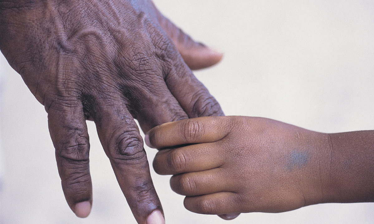 Reconciliation towards meaningful change - Photo:canva.com